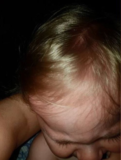 Declan was rushed to the emergency department of the hospital after a fall from his cot left him with a nasty head bump. Picture: Supplied.