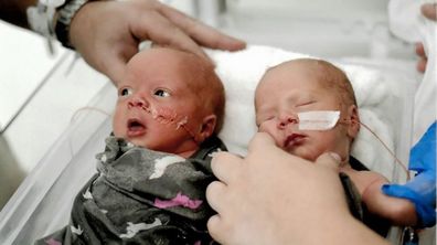twin babies delivered by twin nurses 4