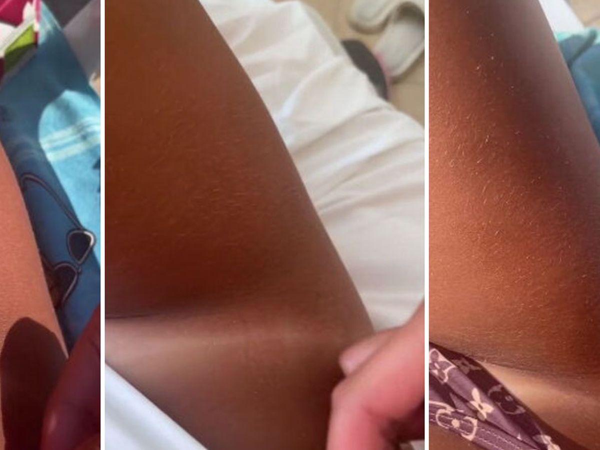 melanotan australia No, you don't need the 'Barbie drug' to tan, whatever TikTok says. Here's  why melanotan-II is so risky main image 0