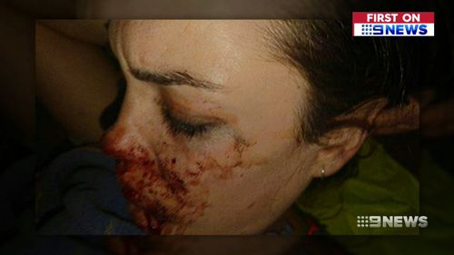Ms Smith was left bloodied and bruised from the incident. (9NEWS)