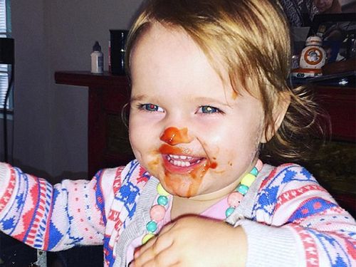 Social media users warn David Campbell's daughter shows sign of eye cancer