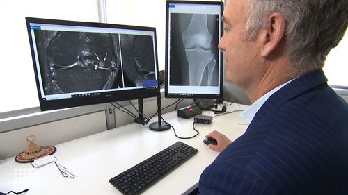 Researchers said new therapies are urgently needed for the two million Australians with knee osteoarthritis.