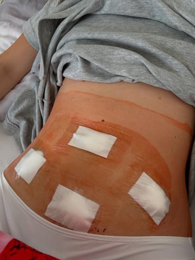 Barbara Palvin opens up about endometriosis in Instagram post