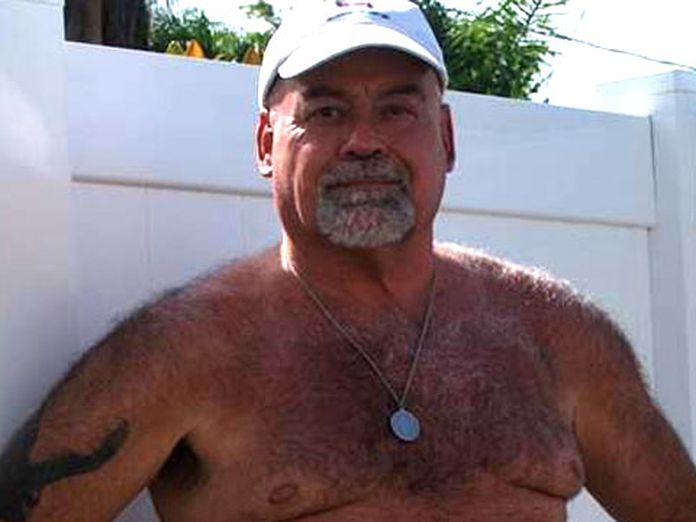 Man opens up about having penis and testicles removed