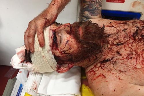 Daniel Broadhurst has been attacked with a machete in Borneo.