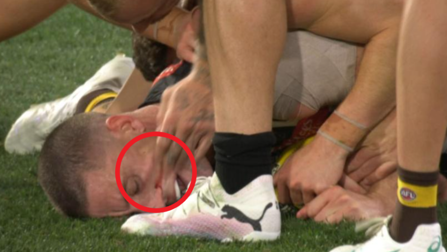 De Goey was caught wiping blood from Cameron&#x27;s face.