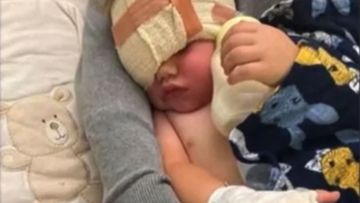 Mothers warning after toddler loses eye