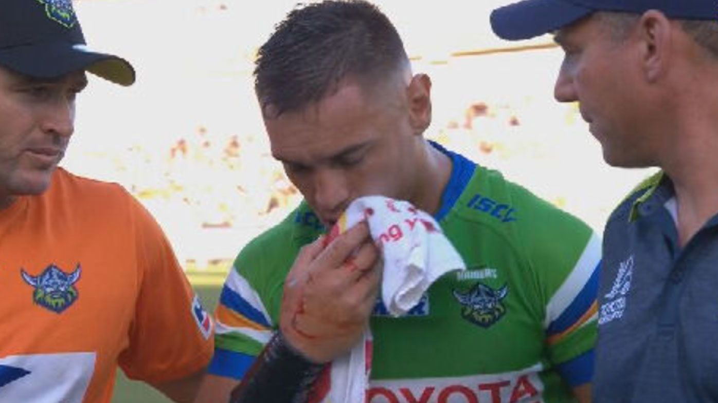 Raiders star Danny Levi was forced off the field after suffering a suspected broken jaw