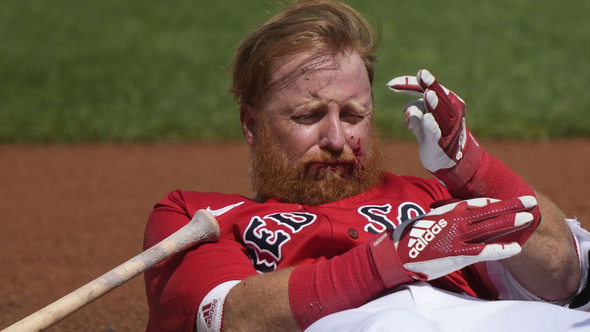 Red Sox' Justin Turner steps into batter's box for first time since being  hit in face by pitch – Blogging the Red Sox