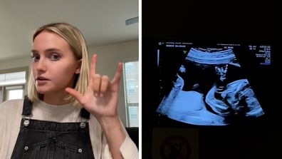 Side by side image of mum-to-be signing 'i love you' and her unborn baby in ultrasound scan making same gesture