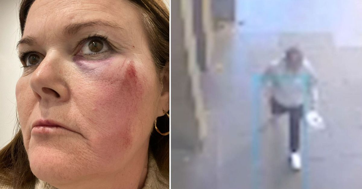 ‘Shocking’: Woman attacked while riding e-scooter in Melbourne