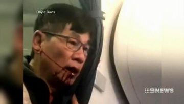 VIDEO: United passenger suing airline after on-board incident