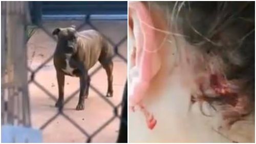Dogs seized after attack on young Perth girl 