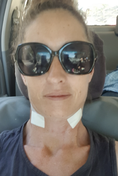 Woman with two children hypermobility surgery needed