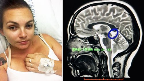 Queensland mum fights medical diagnosis after cyst found on brain