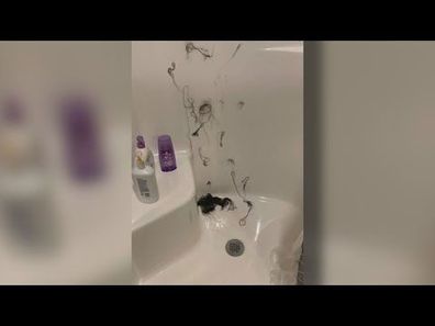 Woman claims shampoo was 'tampered with' after hair falls out