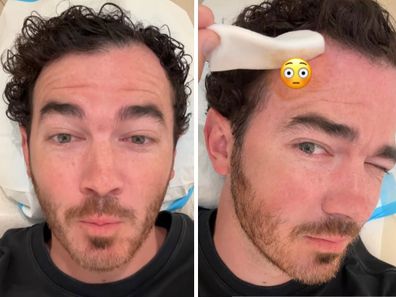 Kevin Jonas skin cancer video split image