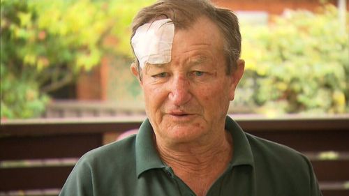 The victim, Norm, was left with a broken nose and ribs. (9NEWS)