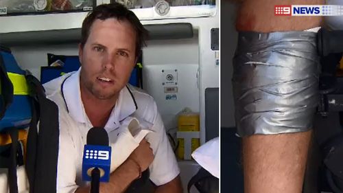 Scott van Burck patched up his own shark bite wound. (9NEWS)