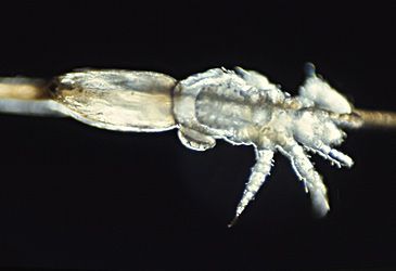 What is the taxonomic name of the head louse?