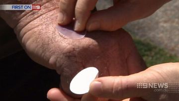 VIDEO: Small patch signifies sunscreen breakthrough