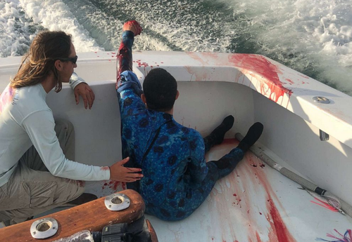 A spearfisherman was lucky enough to be rescued by a boat full of nurses after he was bitten by a shark off the coast of Florida.