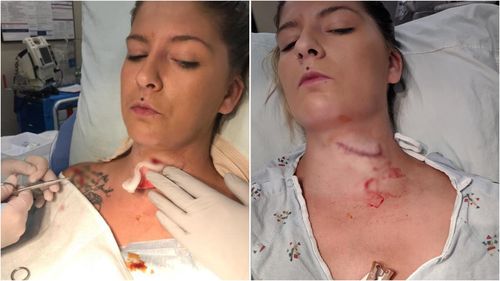Kendra Jensen was rushed to hospital when a shard flew out from under the lawn mower and slashed open her neck from across the yard.