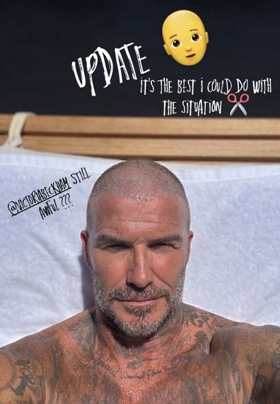 David Beckham reveals bad hair