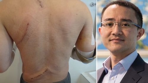 Dr Wong almost lost his life when he was stabbed 14 times by a mentally ill patient. 