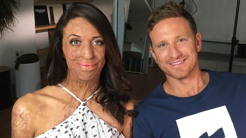 Turia Pitt and Michael Hoskin are expecting a boy. 