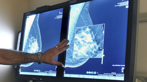 About 20,000 Australians are diagnosed with breast cancer each year. Genomic testing could benefit up to 5,000 of those women, Dr Tim Clay says.  