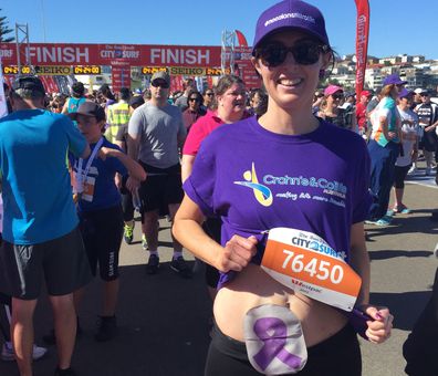 Sam Abarca, pictured running the City to Surf, had her bowel removed due to ulcerative colitis, but a new drug called Golimumab, branded as Simponi, could help patients avoid that. 