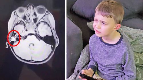 Oliver Jepson pictured left, was diagnosed with a rare brain cancer, pictured right is the moment his mother first noticed something was wrong.