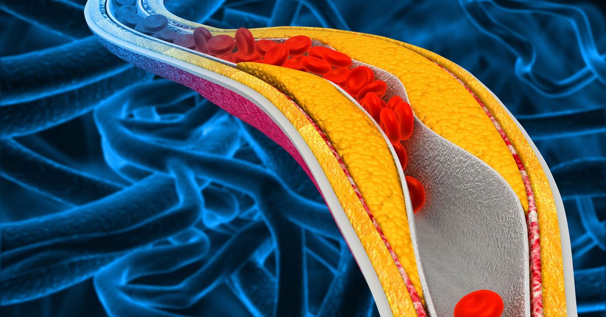 New Enlicitide pill could be the drug to help those with high cholesterol