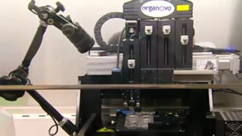 The 3D printer has the ability to create "mini kidneys". (9NEWS)