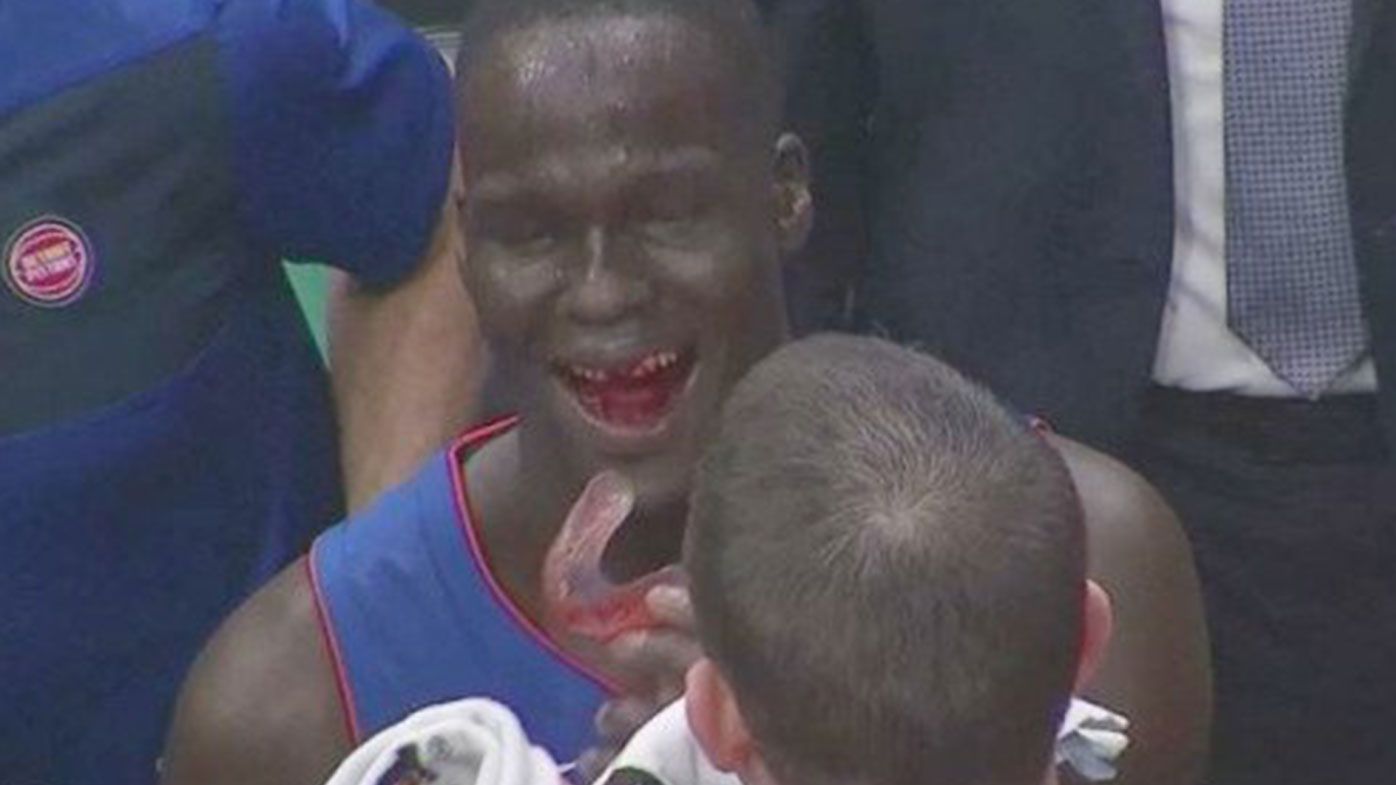 Thon Maker stars for Detroit Pistons despite being left bloodied