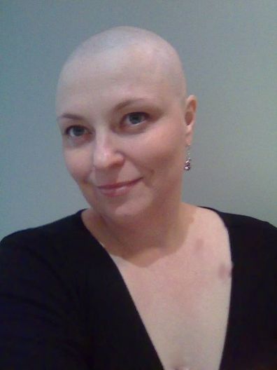 Rachael during her treatment for triple negative breast cancer