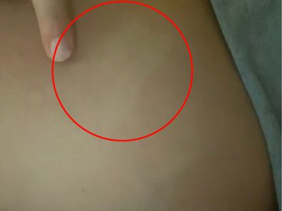 Mum notices baby's footprint on her stomach