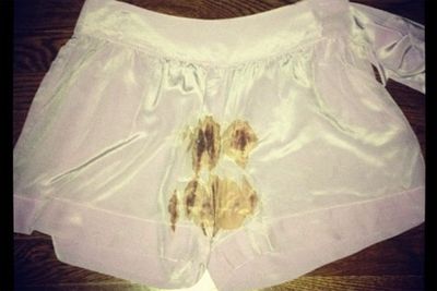 Don't puke, it's not what you think. Kelly Osbourne tweeted this pic after her tanning lotion exploded in her suitcase, staining her shorts in a most unfortunate way.