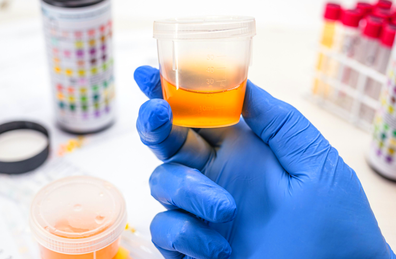 Urine sample in a lab 