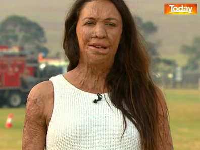 Grass fire survivor Turia Pitt has found the bushfire crisis triggering. 