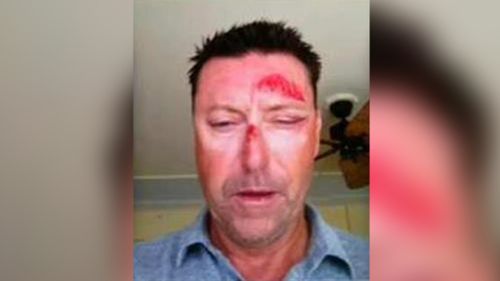 Robert Allenby's former caddie doesn't believe golfer was drugged and kidnapped