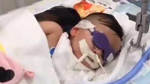 One-year-old Marwa in a medically-induced coma. (Facebook)