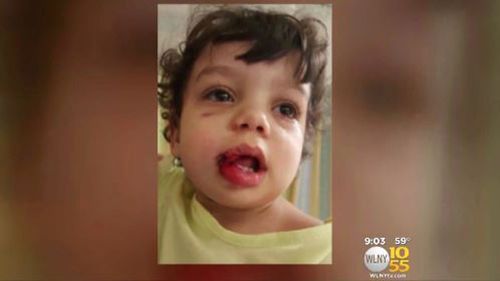 US toddler shot in the face by stray bullet in car