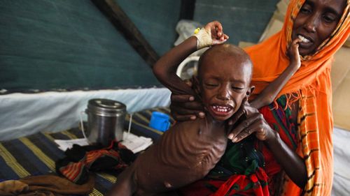 A Somali mother holds her severely malnourished baby boy at a clinic in sprawling Dadaab refugee camp, 2011. Source: AAP