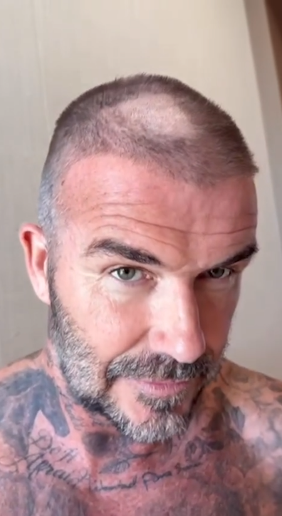 David Beckham reveals bad hair