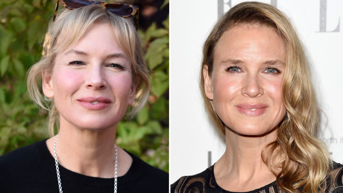 Renee Zellweger Faced International Humiliation Over Cosmetic Surgery Rumours 9celebrity