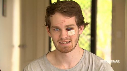 "They terrorised my sister, I came downstairs, they came for me." (9NEWS)