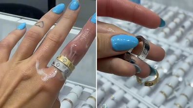 Vanessa Sierra forced to have her rings cut off a swollen finger