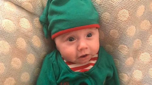 UK baby flashes first smile before Christmas after dangerous cyst removed